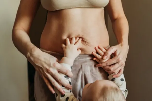 سزارین بعد از ابدومینوپلاستی