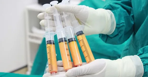 ماندگاری تزریق چربی