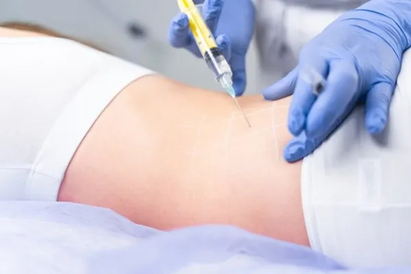 تزریق چربی برای افراد لاغر