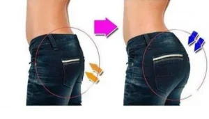 مراقبت‌های بعد از تزریق چربی به باسن