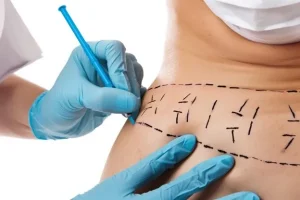 فرق لیپوماتیک و لیپوساکشن