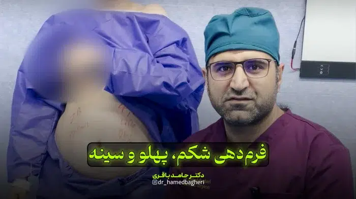 فرم دهی شکم، پهلو و سینه | دکتر حامد باقری