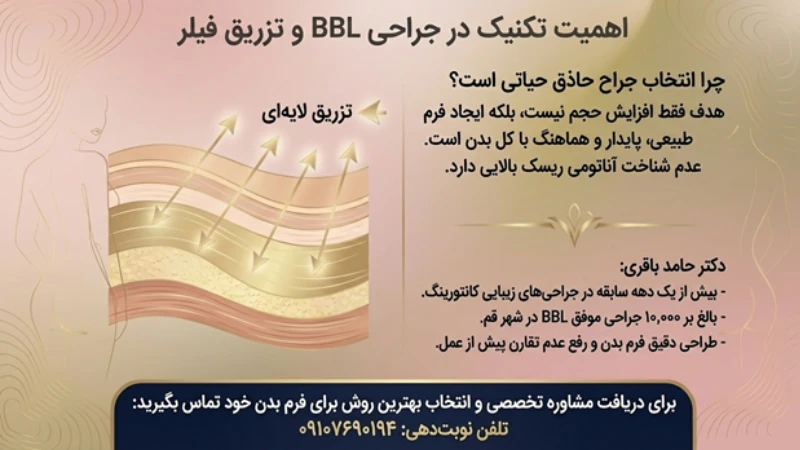 فیلر باسن چیست