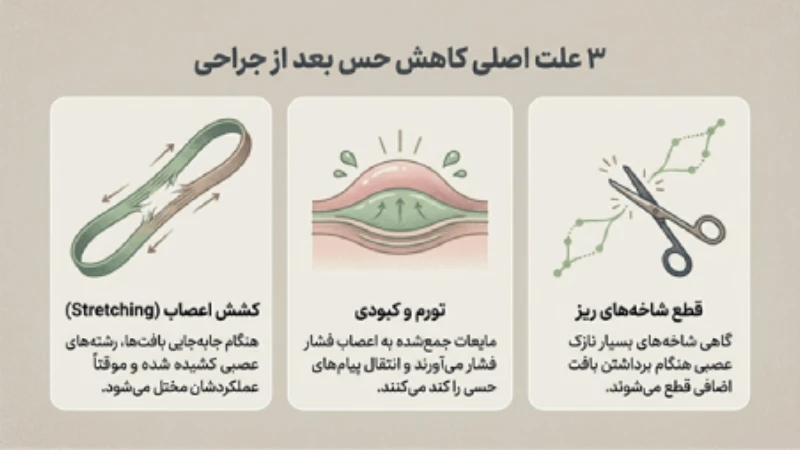 بی حسی نوک سینه بعد از ماموپلاستی