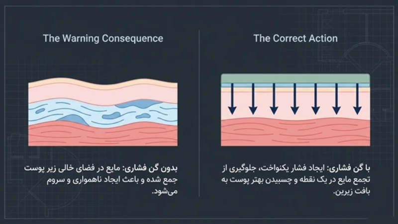 نکات مراقبتی بعد از لیپوساکشن