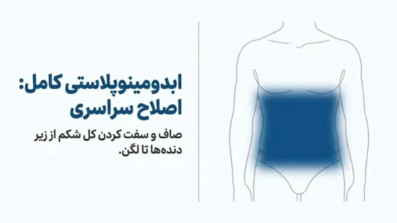 ابدومینوپلاستی کامل و مینی ابدومینوپلاستی