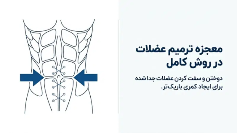 ابدومینوپلاستی کامل و مینی ابدومینوپلاستی