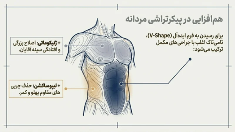 ابدومینوپلاستی در آقایان