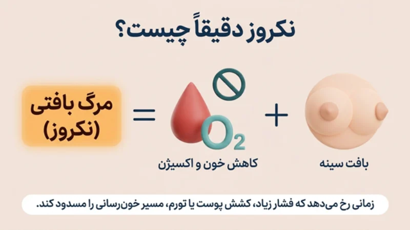 نکروز چربی سینه