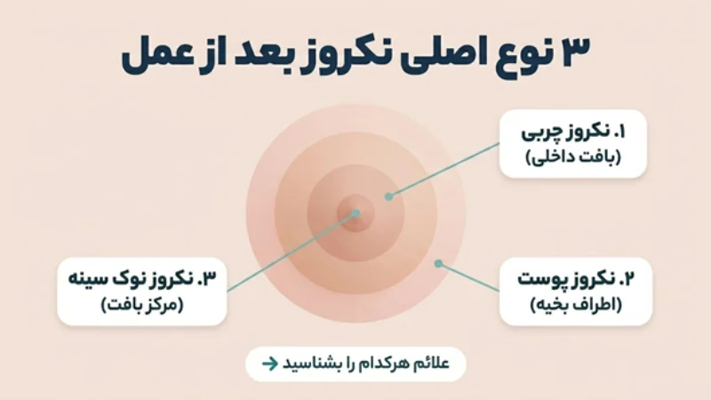 نکروز چربی سینه