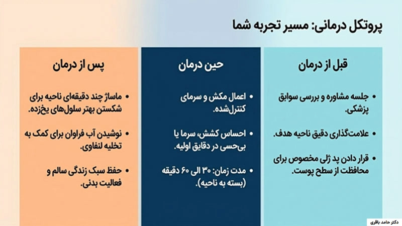 لاغری موضعی با کرایولیپولیز