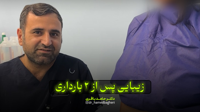 زیبایی پس از 2 بارداری | دکتر حامد باقری