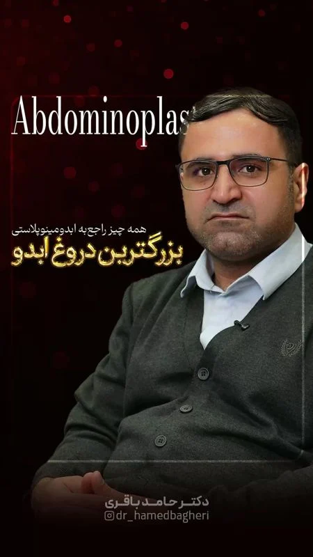شرایط و کاندیدای مناسب عمل ابدومینوپلاستی