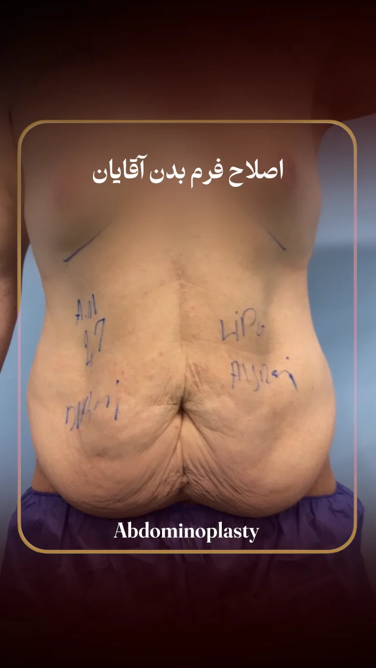 رسیدن به وزن ایده‌آل فقط نصف راهه!