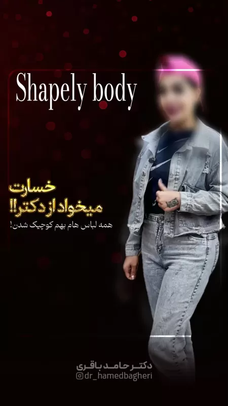 چالش جذاب بعد از عمل زیبایی!