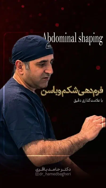 طراحی خطوط بدن، قدم اول پیکرتراشی