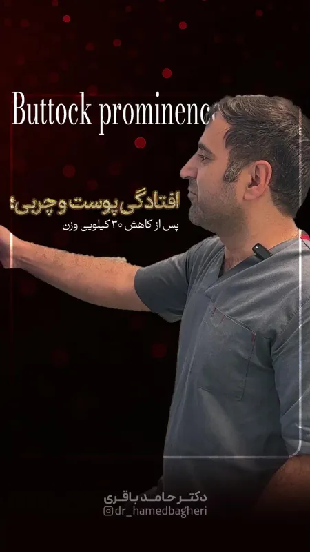 پیکرتراشی و فرم‌دهی تخصصی پس از کاهش وزن